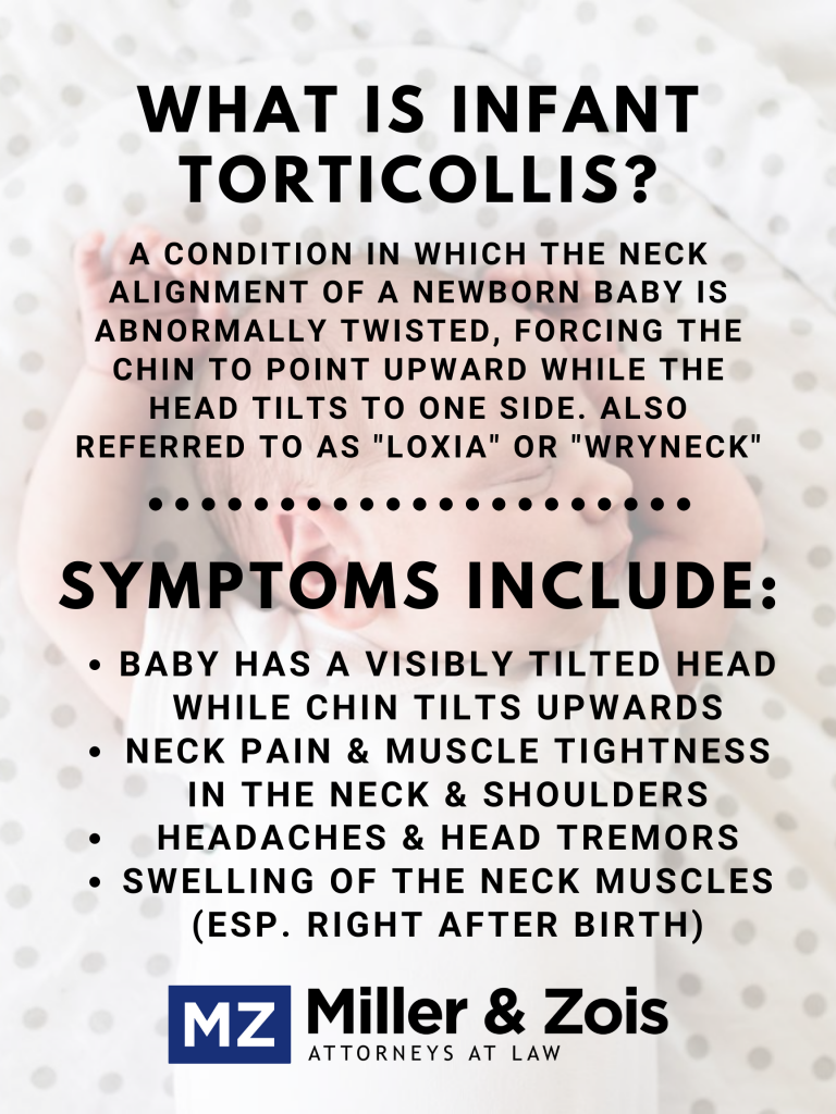 Infant torticollis